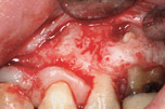 endodonzia fase1